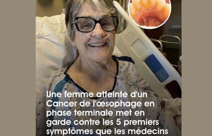 Cancer de l’œsophage : une patiente révèle 5 signes précoces souvent omis par les médecins