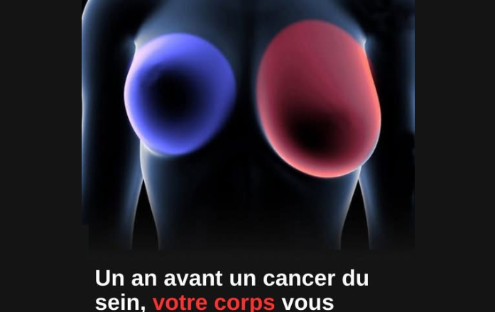 Cancer du sein : 4 signes précoces à ne jamais ignorer pour agir rapidement