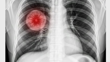 Vaccin contre le Covid-19 : cinq ans après, la liste des symptômes persistants s’allonge