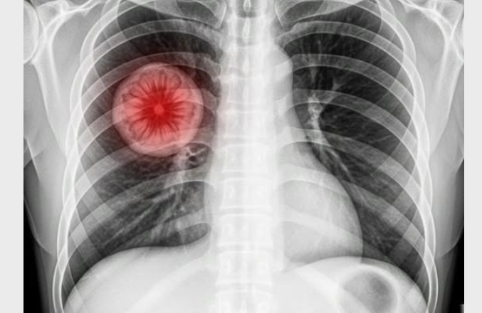 Vaccin contre le Covid-19 : cinq ans après, la liste des symptômes persistants s’allonge